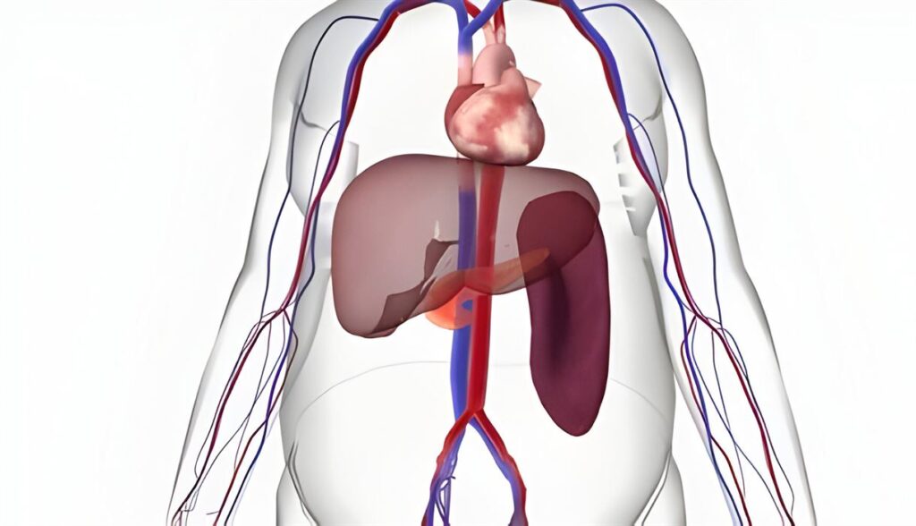 Les Causes de l'Hypertriglycéridémie